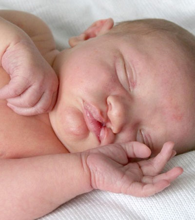 Congenital Abnormalities