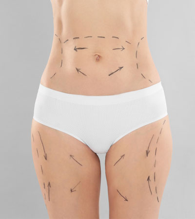Body Cosmetic Surgery in Ongole